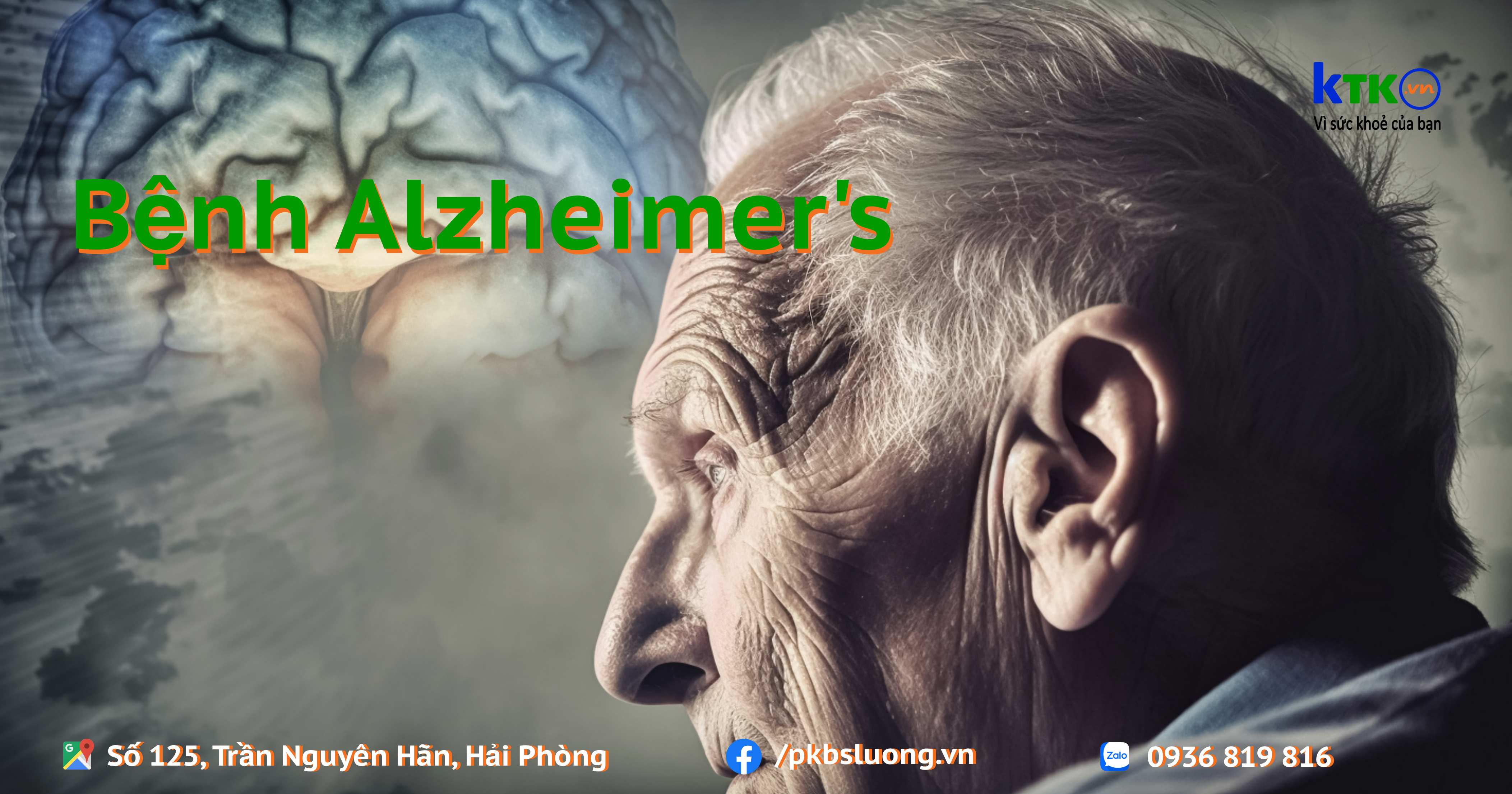 Điều trị bệnh Alzheimer’s.